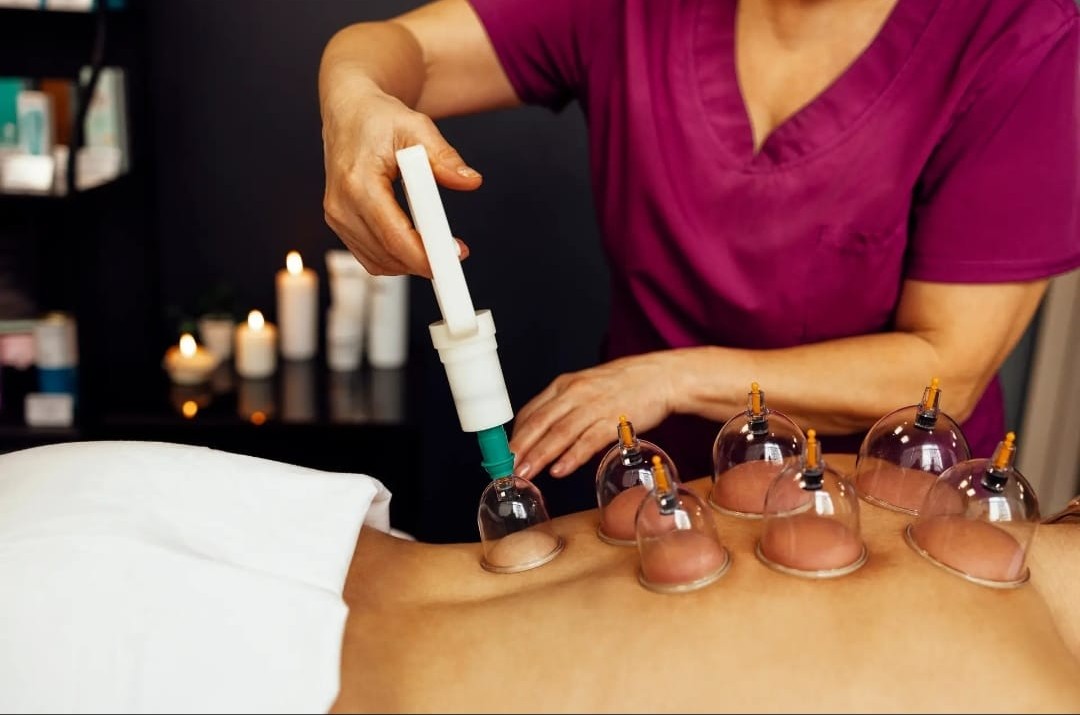 Hijama Dry Cupping Therapy